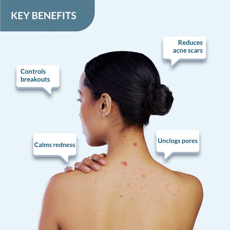 4x FIXDERMA Salyzap 2% Salicylic Acid Body Wash - 200ml each (Pack of 4) - Image 3